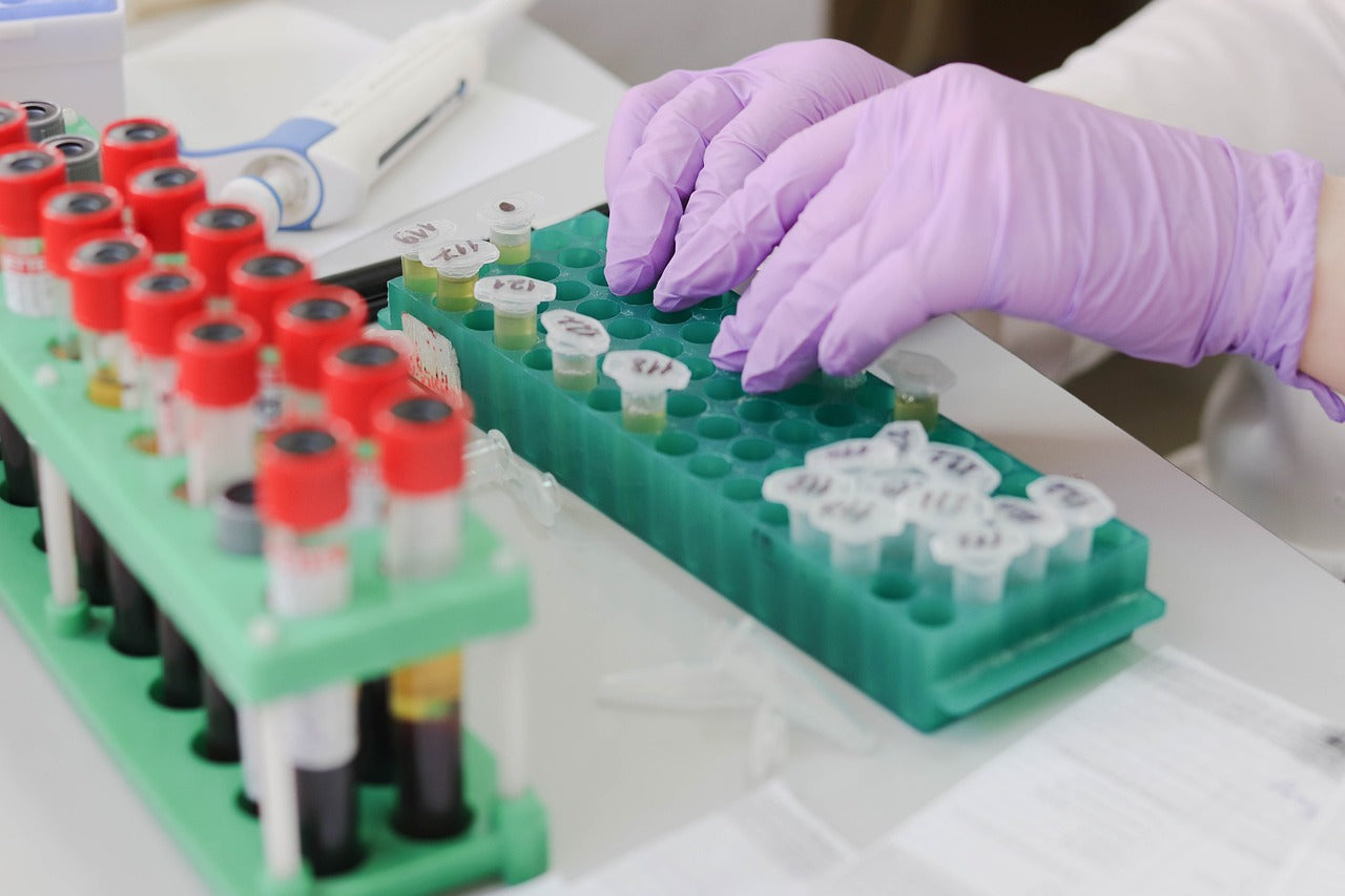 O que é o rastreio do Câncer de colo do útero e sua relação com o HPV?