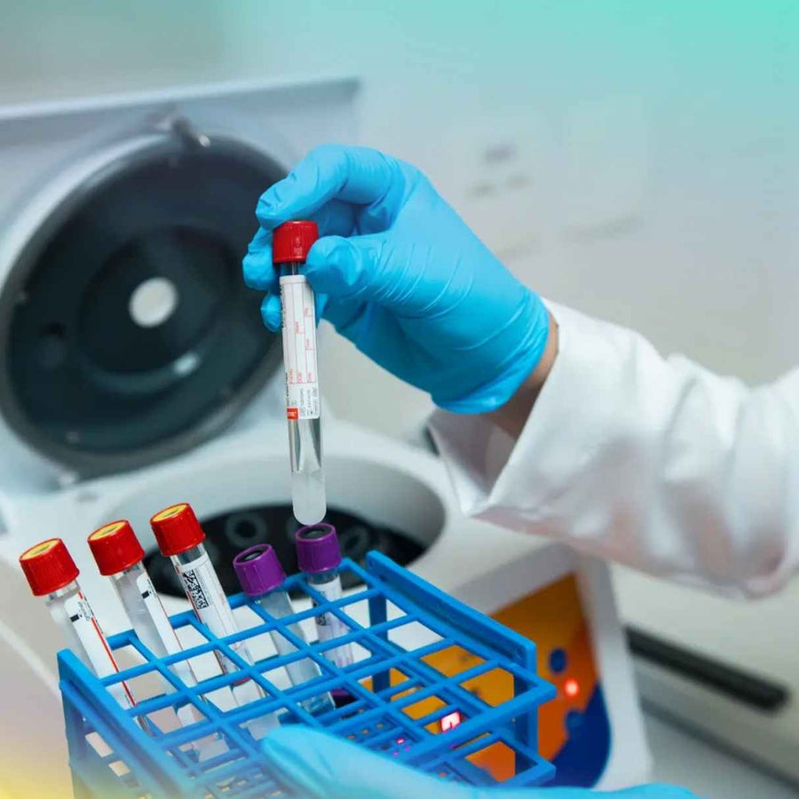 Exame de Cortisol Salivar