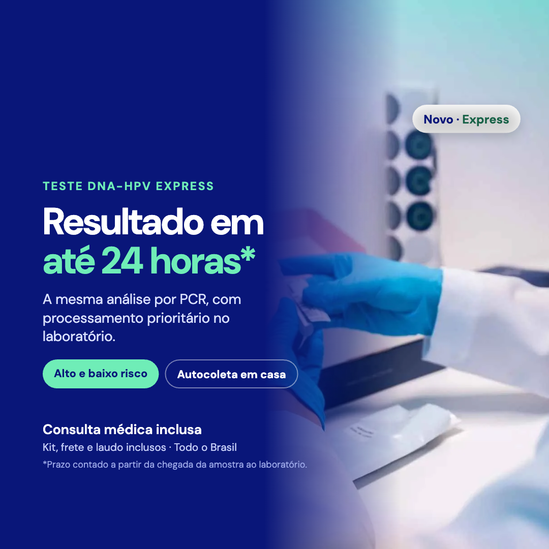 Teste DNA-HPV Express da Vinci Lab: resultado em até 24 horas após a chegada da amostra ao laboratório, com autocoleta em casa e consulta médica inclusa
